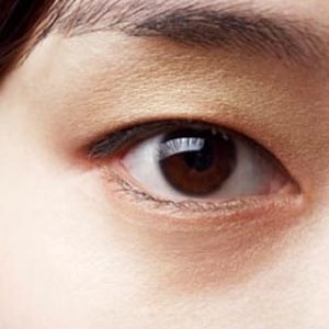 symptoms-cataract